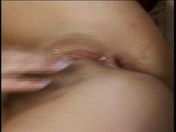 Captura de 'Irritable Bowel Syndrome 3' nº 138