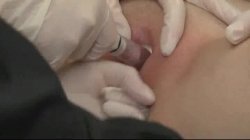Captura de 'Lesbian Hospital' nº 110