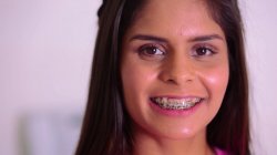 Captura de 'Brace Face' nº 89