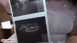 'In Her Final Weeks, She Glows with a Quiet, Expectant Beauty' screenshot nº 3