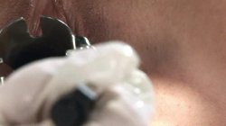 'Lesbian Strap On Nurses' screenshot nº 55