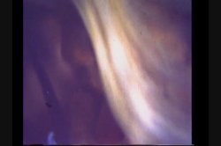 Captura de 'Gozangas' nº 21