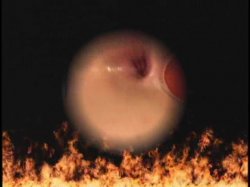 Captura de 'Anal Thrills' nº 1