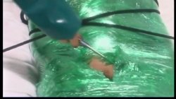 Captura de 'Rubber Sanitarium' nº 139